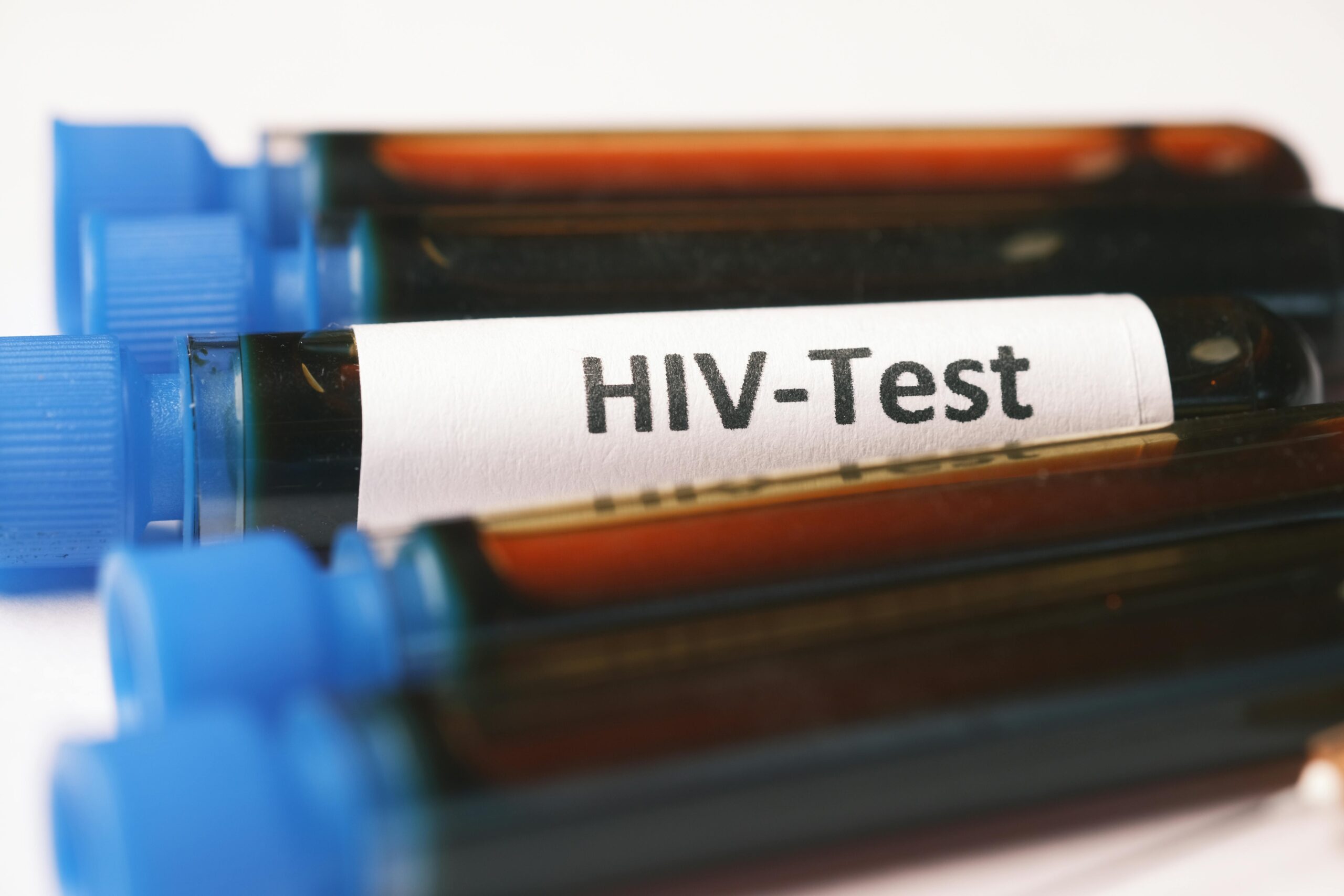Sexually Transmitted Diseases